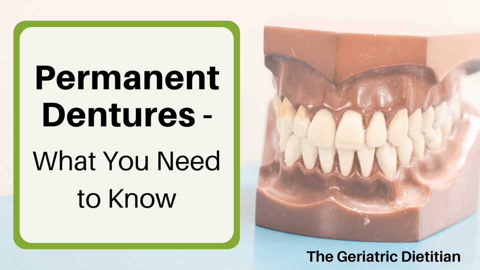 Fixed Dentures On Implants  : Implant Supported Dentures Require 4 Or More Implants Are To Be Used To Hold The Denture In Place With Screws Securing The Denture To The Implant.